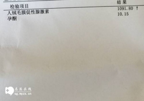 葡萄籽有助于调节月经周期吗,葡萄籽经期可以吃吗